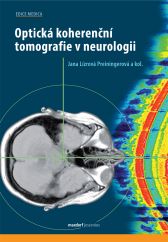 Optická koherenční tomografie v neurologii